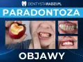 Krwawiące dziąsła po ugryzieniu jabłka, odsłonięte szyjki zębów i narzędzia dentystyczne – to objawy paradontozy.