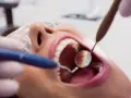 Pacjentka u dentysty, zastanawia się, czy piaskowanie zębów boli. Widać narzędzia stomatologiczne i otwarte usta.