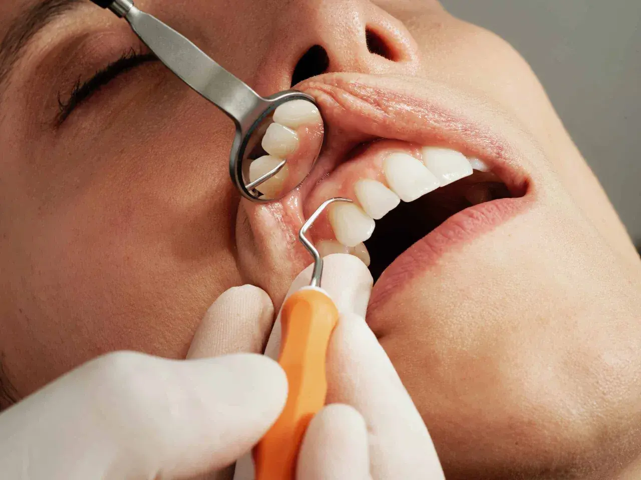Dentysta używa narzędzi do badania zębów. Zastanawiasz się, ile trwa wyrywanie zęba?
