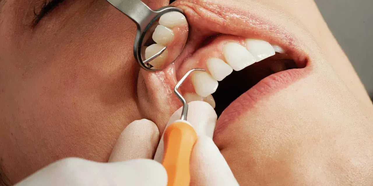 Dentysta używa narzędzi do badania zębów. Zastanawiasz się, ile trwa wyrywanie zęba?