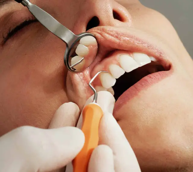 Dentysta używa narzędzi do badania zębów. Zastanawiasz się, ile trwa wyrywanie zęba?