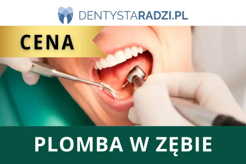 Dentysta zakłada plombę w zębie. Widoczna jest cena zabiegu.